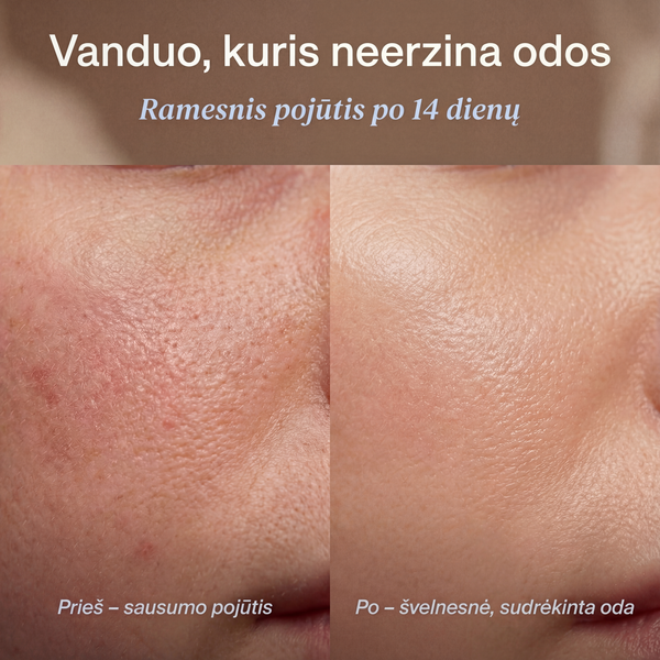 3-1 Premium Filtruojama Dušo Galvutė