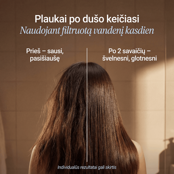 3-1 Premium Filtruojama Dušo Galvutė