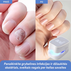 ClearNail – Pažangus sprendimas nuo nagų grybelio