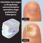 ClearNail – Pažangus sprendimas nuo nagų grybelio