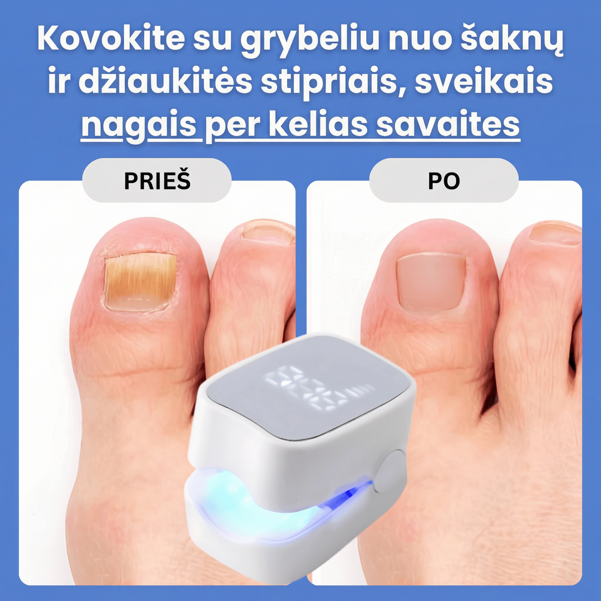 ClearNail – Pažangus sprendimas nuo nagų grybelio