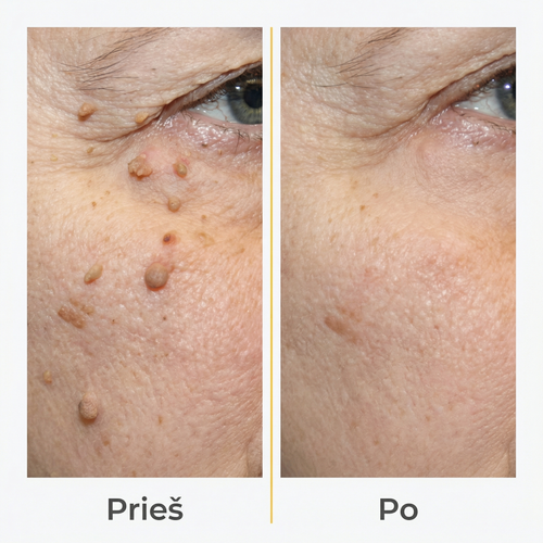 Bičių Aktyvusis Odos Priežiūros Purškalas