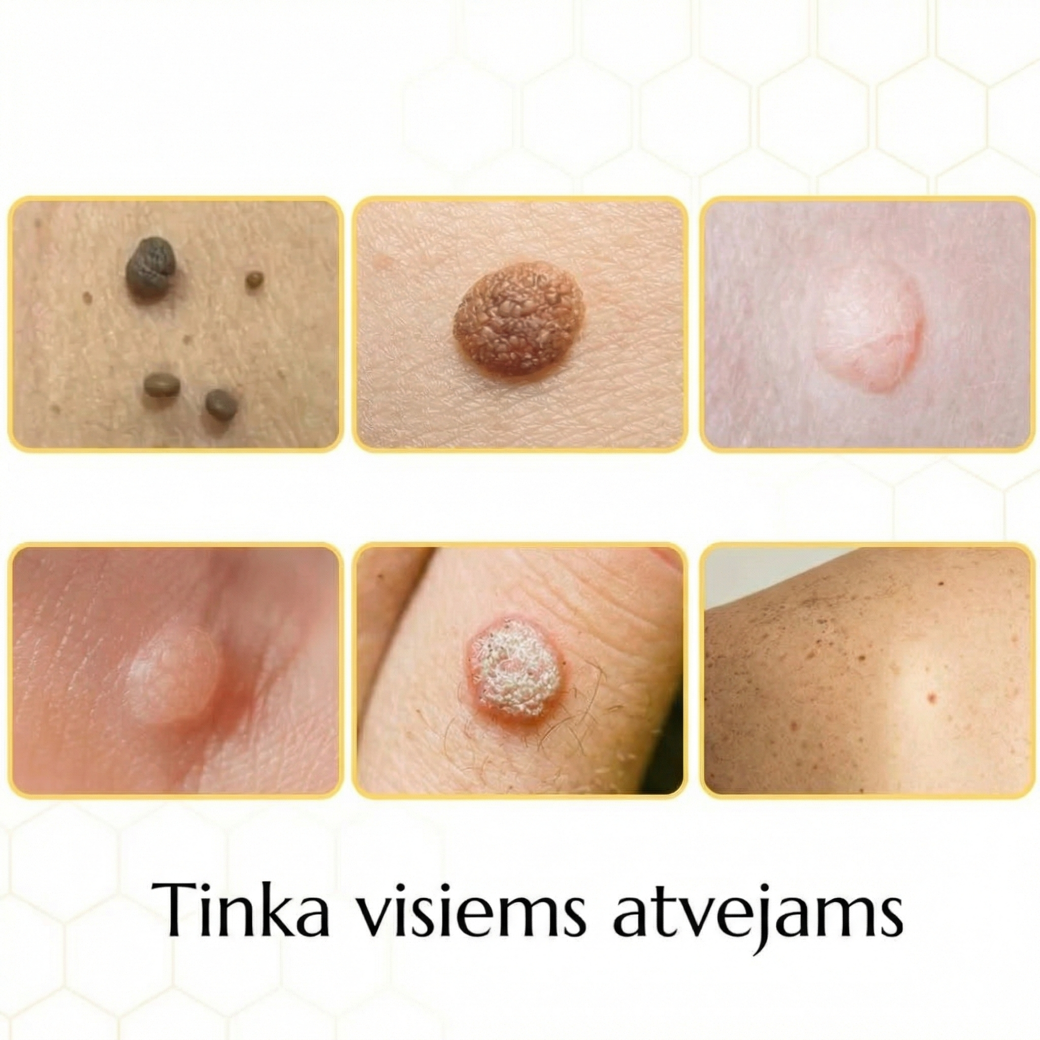 Bičių Aktyvusis Odos Priežiūros Purškalas